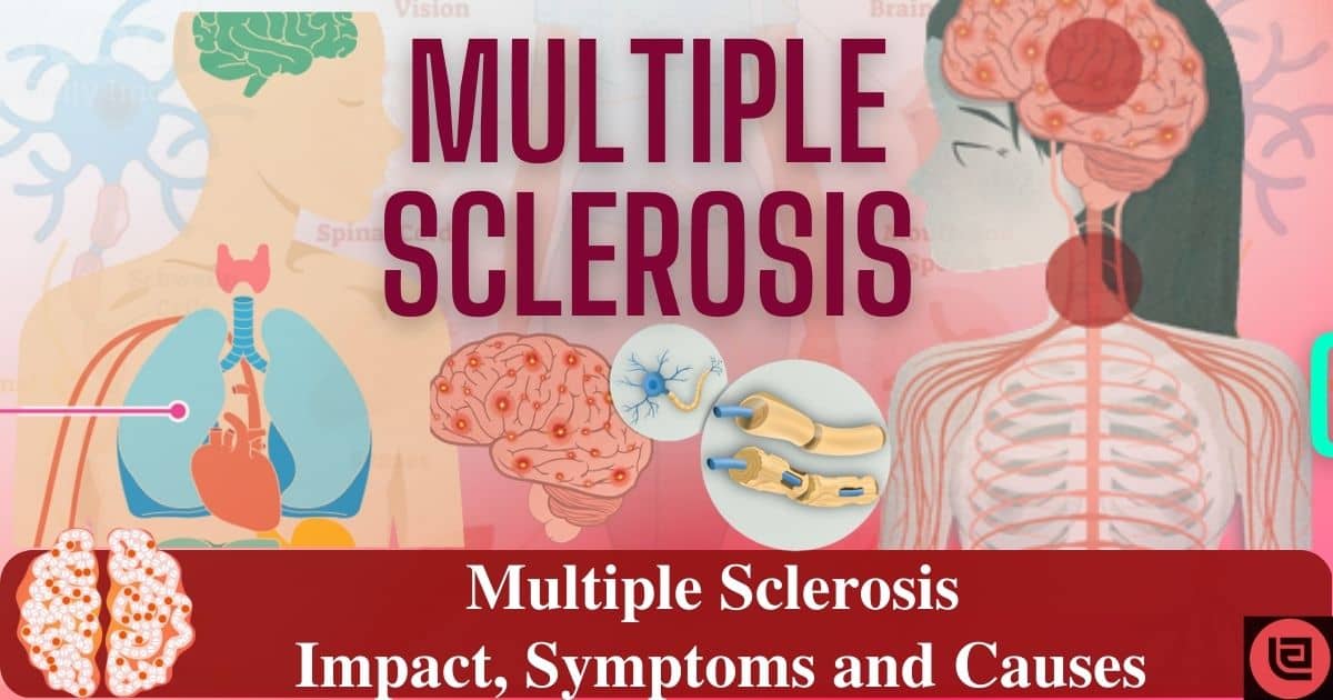 Multiple Sclerosis, its Impact, Symptoms and the Causes